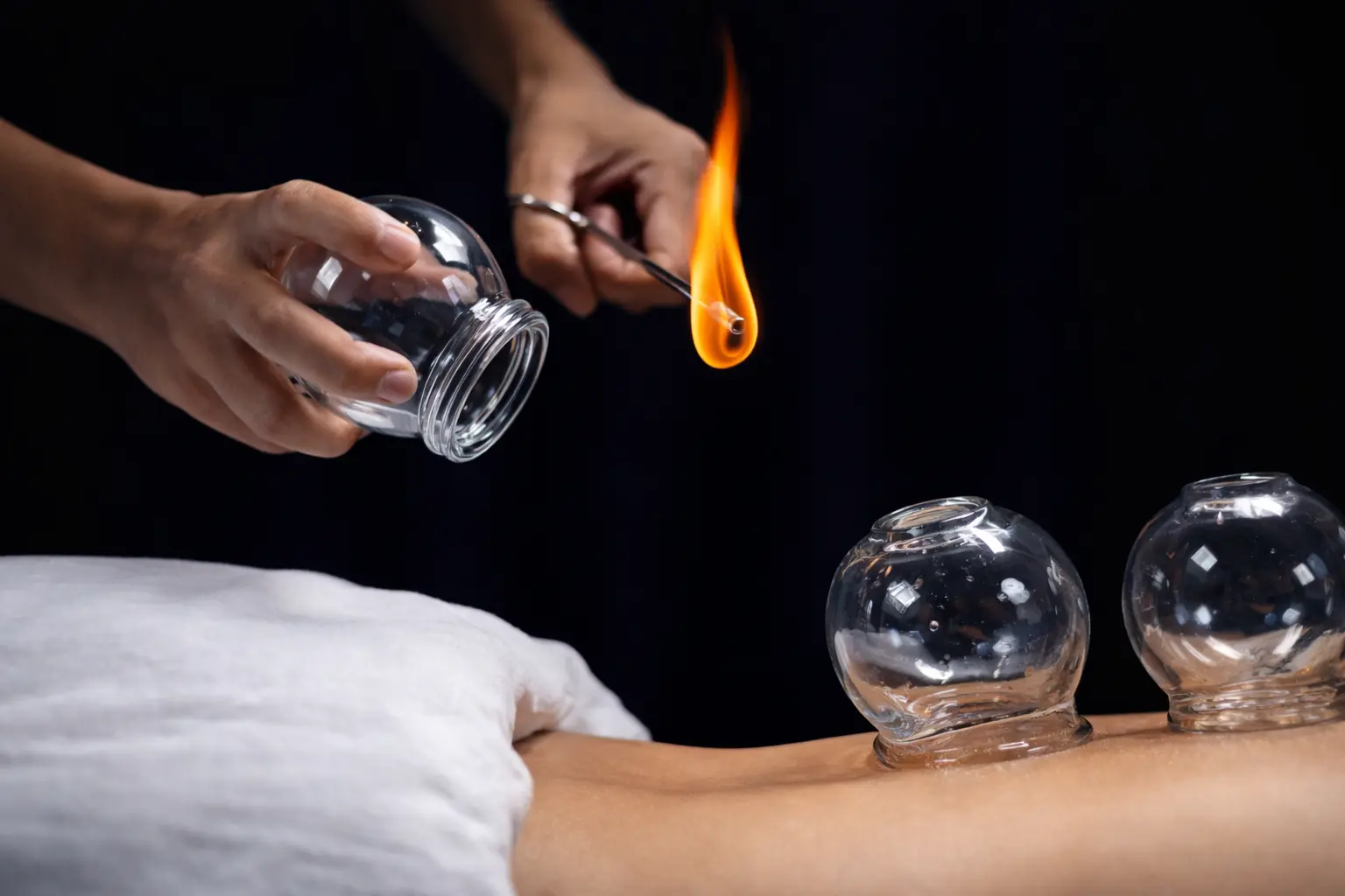 Terapia con ventosas